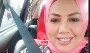 Elly Sugigi setelah potong gigi. (internet)..